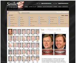 smiletexas.com smile gallery